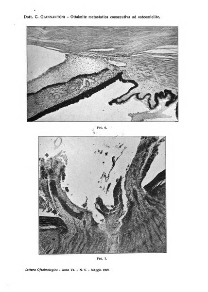 Lettura oftalmologica rivista mensile di oculistica pratica