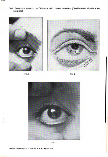 Lettura oftalmologica rivista mensile di oculistica pratica