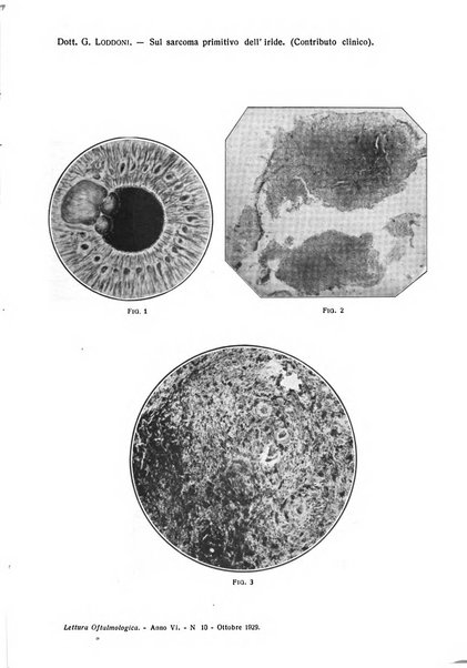 Lettura oftalmologica rivista mensile di oculistica pratica