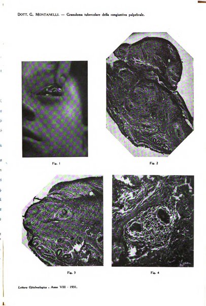 Lettura oftalmologica rivista mensile di oculistica pratica