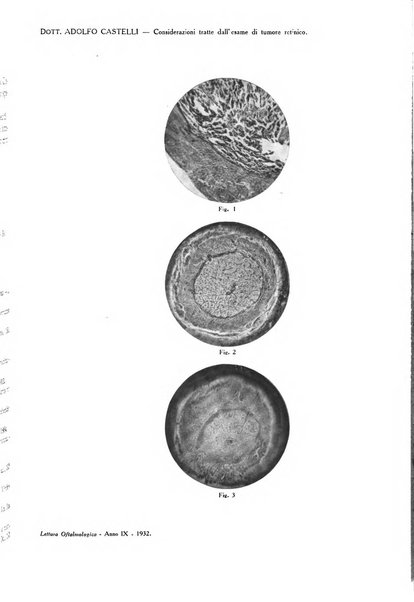 Lettura oftalmologica rivista mensile di oculistica pratica