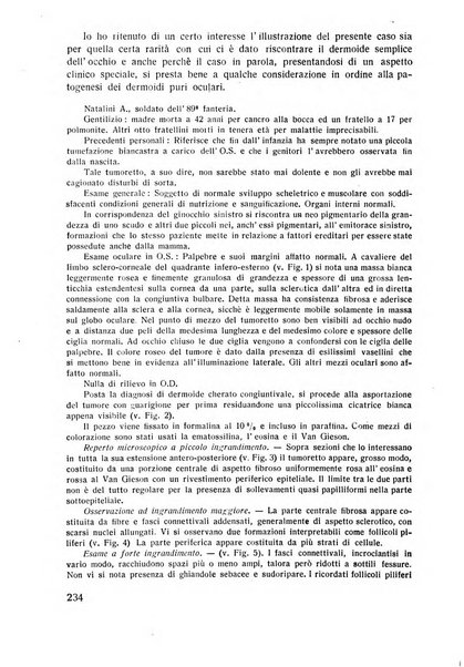 Lettura oftalmologica rivista mensile di oculistica pratica