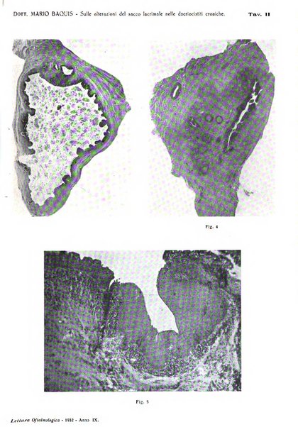 Lettura oftalmologica rivista mensile di oculistica pratica