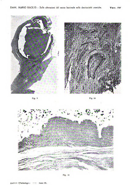 Lettura oftalmologica rivista mensile di oculistica pratica