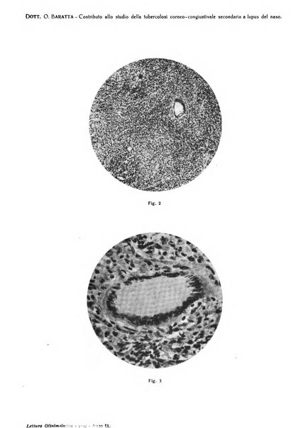 Lettura oftalmologica rivista mensile di oculistica pratica