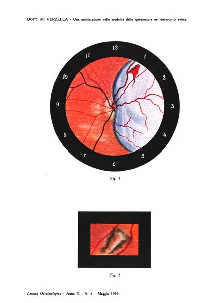 Lettura oftalmologica rivista mensile di oculistica pratica