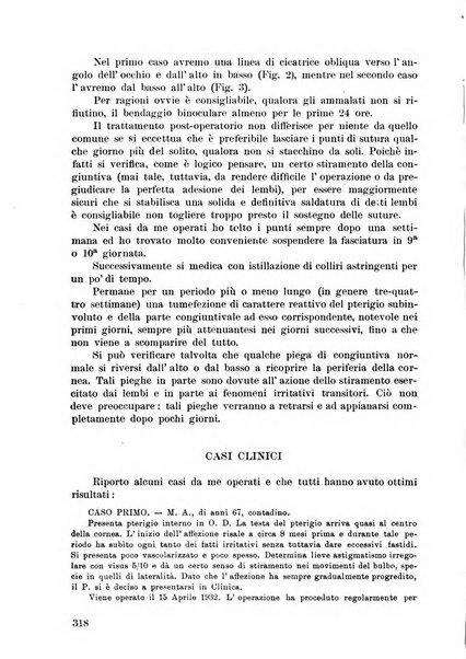 Lettura oftalmologica rivista mensile di oculistica pratica