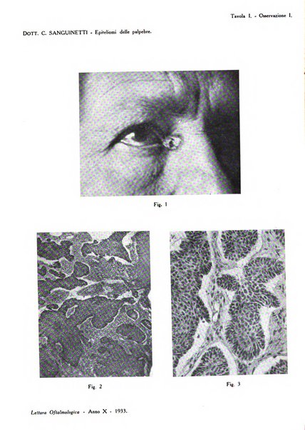 Lettura oftalmologica rivista mensile di oculistica pratica