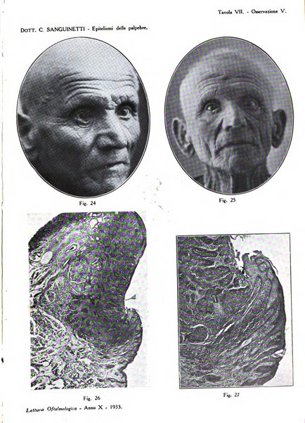 Lettura oftalmologica rivista mensile di oculistica pratica