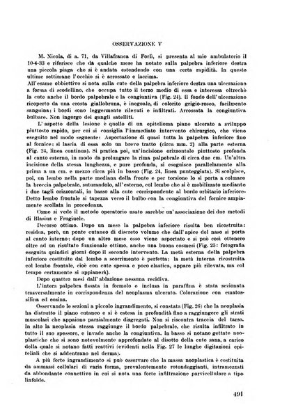 Lettura oftalmologica rivista mensile di oculistica pratica