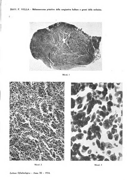 Lettura oftalmologica rivista mensile di oculistica pratica