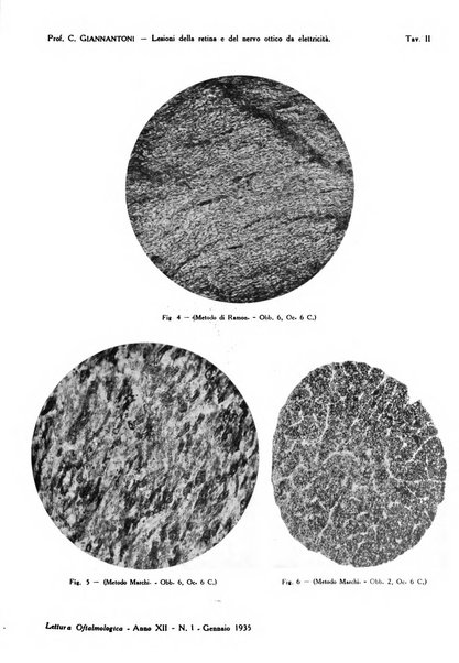 Lettura oftalmologica rivista mensile di oculistica pratica