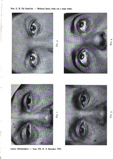 Lettura oftalmologica rivista mensile di oculistica pratica