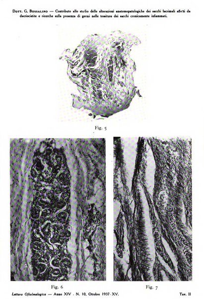 Lettura oftalmologica rivista mensile di oculistica pratica