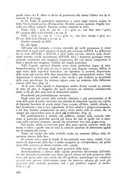 Lettura oftalmologica rivista mensile di oculistica pratica