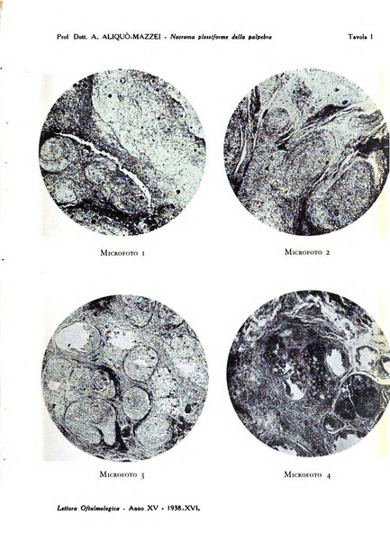 Lettura oftalmologica rivista mensile di oculistica pratica