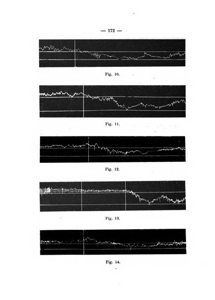 Giornale di batteriologia e immunologia bollettino clinico ed amministrativo dell'Ospedale Maria Vittoria