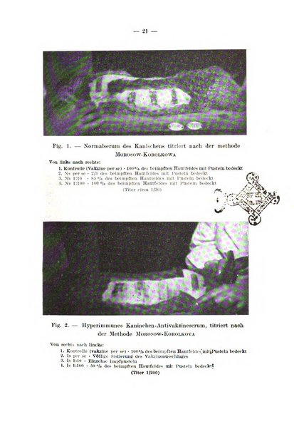 Giornale di batteriologia e immunologia bollettino clinico ed amministrativo dell'Ospedale Maria Vittoria