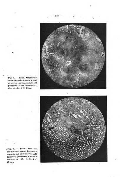 Giornale di batteriologia e immunologia bollettino clinico ed amministrativo dell'Ospedale Maria Vittoria