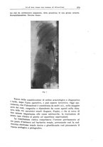 giornale/CFI0354001/1933/unico/00000293