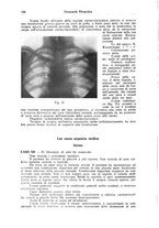 giornale/CFI0354001/1938/unico/00000182
