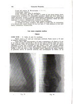 giornale/CFI0354001/1938/unico/00000188