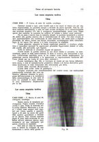 giornale/CFI0354001/1938/unico/00000193