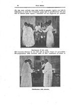 giornale/CFI0354704/1918/unico/00000080