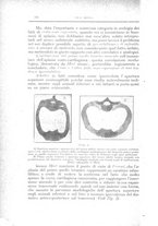 giornale/CFI0354704/1918/unico/00000126