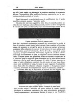 giornale/CFI0354704/1918/unico/00000236