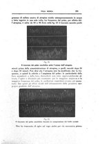 giornale/CFI0354704/1918/unico/00000241