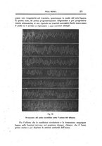 giornale/CFI0354704/1918/unico/00000321