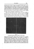 giornale/CFI0354704/1918/unico/00000383