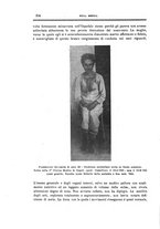 giornale/CFI0354704/1926/unico/00000390