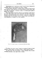 giornale/CFI0354704/1928/unico/00001373