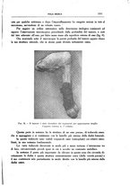 giornale/CFI0354704/1928/unico/00001377