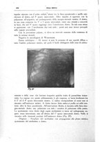 giornale/CFI0354704/1929/unico/00000516