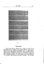 giornale/CFI0354704/1930/unico/00000201