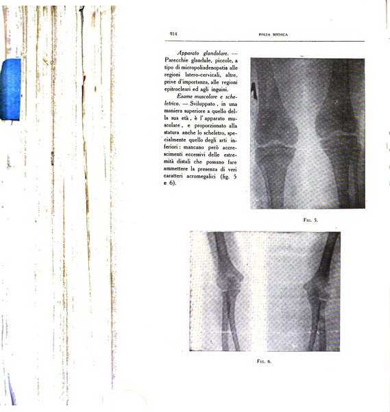 Folia medica periodico trimensile di patologia e clinica medica