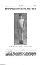 giornale/CFI0354704/1931/unico/00000089