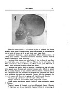 giornale/CFI0354704/1933/unico/00000087