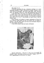 giornale/CFI0354704/1934/unico/00000186