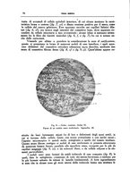 giornale/CFI0354704/1937/unico/00000074