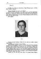 giornale/CFI0354704/1937/unico/00000228