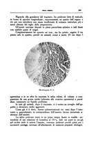 giornale/CFI0354704/1937/unico/00000247