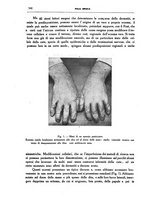 giornale/CFI0354704/1937/unico/00000512