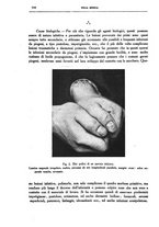 giornale/CFI0354704/1937/unico/00000514