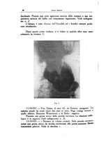 giornale/CFI0354704/1938/unico/00000098