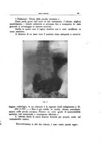 giornale/CFI0354704/1938/unico/00000099