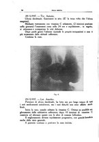 giornale/CFI0354704/1938/unico/00000100